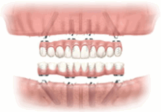 �I�[�����t�H�[