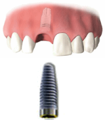 step1 �C���v�����g��