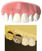 ���Ԃ���