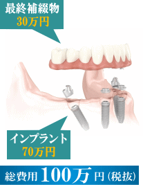 ����p100���~(�Ŕ�)