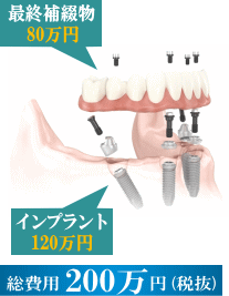 ����p200���~(�Ŕ�)